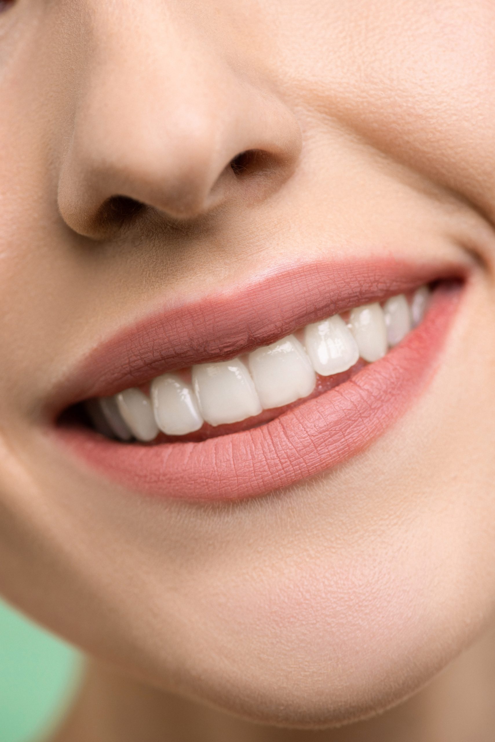 The Benefits of Teeth Whitening