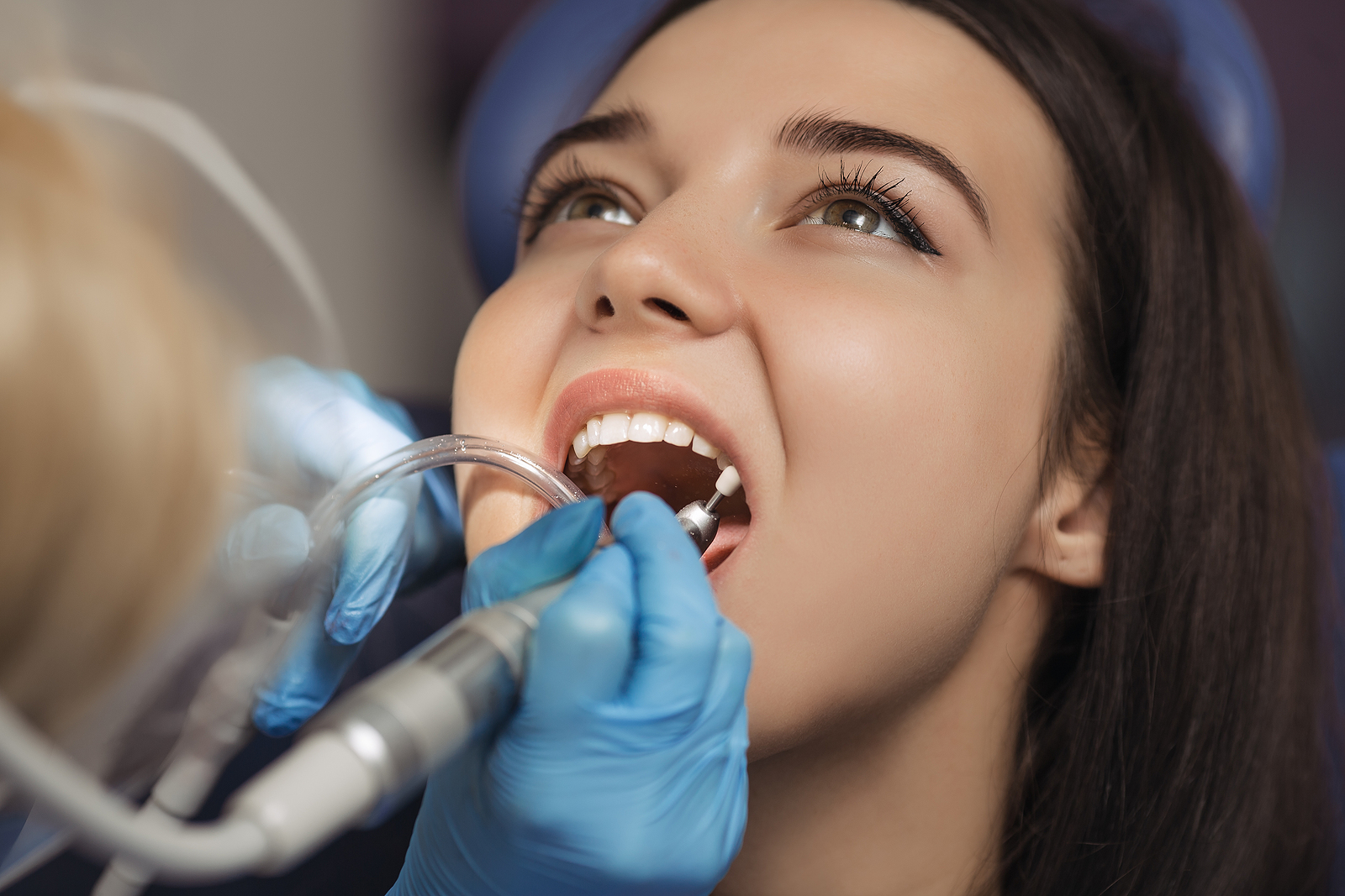 Can I Resume Normal Activities After a Root Canal? A Guide to Getting Back to Your Routine
