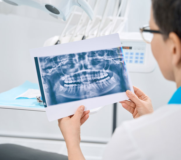 Aurora Interactive Periodontal Probing