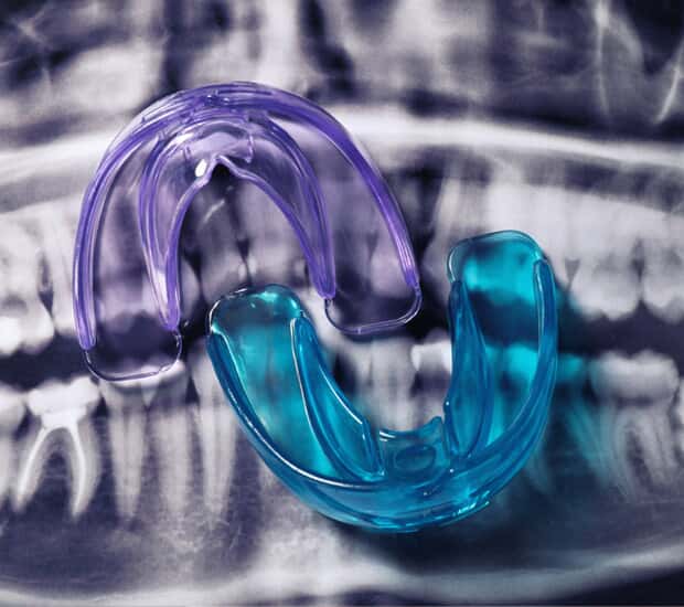 Aurora Mouth Guards